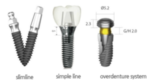덴티움 임플란트 4