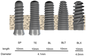 스트라우만 임플란트 3