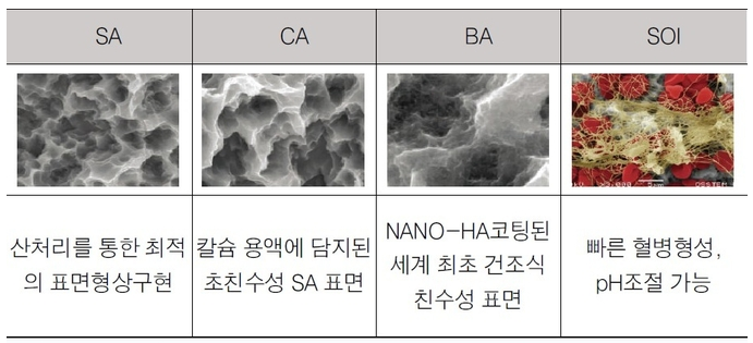 오스템 임플란트 종류