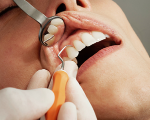 임플란트 뼈이식 2