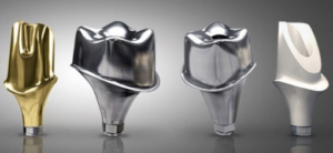 임플란트 보철물 종류