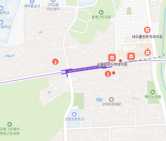 상일동역 임플란트 치과 잘하는곳