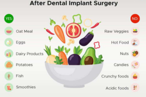 임플란트-후-식사-음식