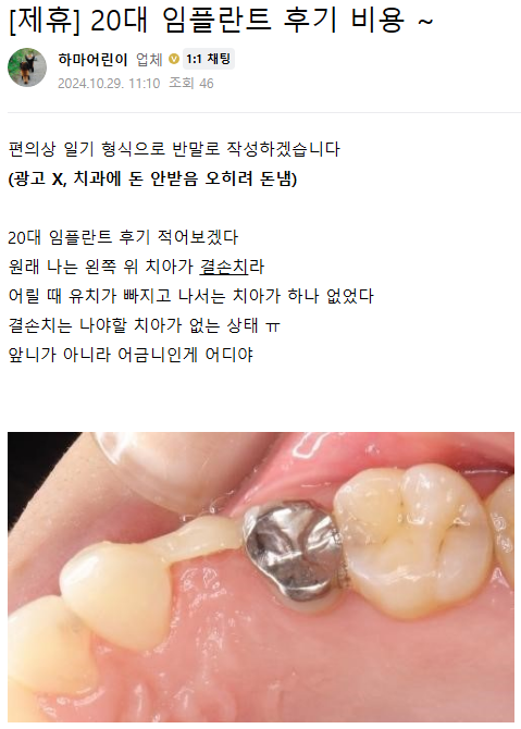 임플란트 후기 1