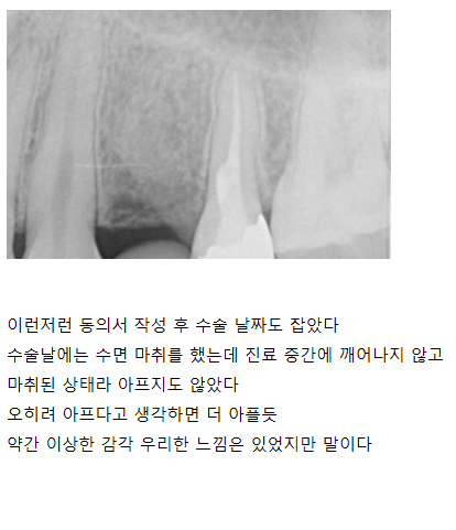 임플란트 후기 4